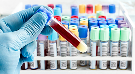 Blood sample